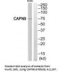 Anti-CAPN9/Calpain 9 Antibody