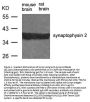 Anti-synaptophysin 2 Synpr Antibody