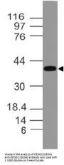 Anti-DEDD2 (DED4) Antibody