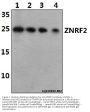 Anti-ZNRF2 Antibody
