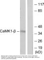 Anti-CaMK1-beta PNCK Antibody