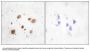 Anti-CaMK1-beta PNCK Antibody