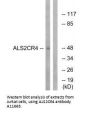 Anti-ALS2CR4 TMEM237 Antibody