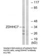 Anti-Palmitoyltransferase ZDHHC7 ZDHHC7 Antibody