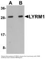 Anti-LYR motif-containing protein 1 LYRM1 Antibody