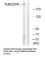 Anti-TUBGCP6/Gcp6 Antibody