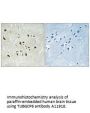 Anti-TUBGCP6/Gcp6 Antibody