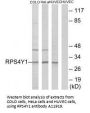 Anti-RPS4Y1 Antibody