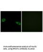 Anti-RPS4Y1 Antibody