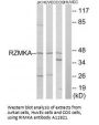 Anti-RIMKA RIMKLA Antibody