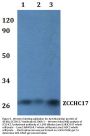 Anti-Nucleolar protein of 40 kDa ZCCHC17 Antibody