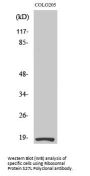 Anti-Ribosomal Protein S27L RPS27L Antibody