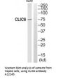 Anti-CLIC6 Antibody