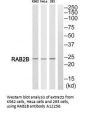 Anti-Ras-related protein Rab-2B RAB2B Antibody