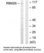 Anti-RNA-binding protein 26 RBM26 Antibody