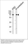 Anti-EPM2AIP1 Antibody (N-term)