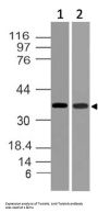 Anti-Twistnb Antibody