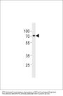 Anti-ST7L Antibody (C-term)