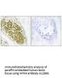 Anti-HIPK4 Antibody
