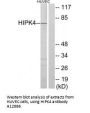 Anti-HIPK4 Antibody