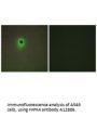 Anti-HIPK4 Antibody