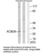 Anti-ACBD6 Antibody