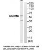Anti-GSDMC/Gasdermin C Antibody