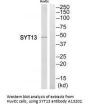 Anti-SYT13/Synaptotagmin 13 Antibody