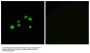 Anti-Collagen XXIII alpha1 COL23A1 Antibody