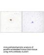Anti-JKIP2 JAKMIP2 Antibody