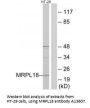 Anti-MRPL18 Antibody