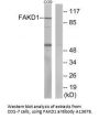 Anti-FAKD1 FASTKD1 Antibody