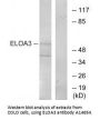 Anti-ELOA3 TCEB3C Antibody