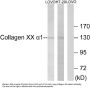 Anti-Collagen XX alpha1 COL20A1 Antibody
