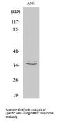 Anti-GPR82 Antibody