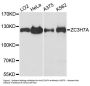 Anti-ZC3H7A Antibody