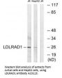 Anti-LDLRAD1 Antibody