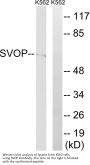 Anti-SVOP Antibody