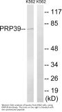 Anti-Pre-mRNA-processing factor 39 PRPF39 Antibody
