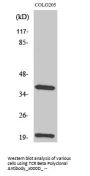 Anti-TCR beta Antibody