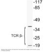 Anti-TCR beta Antibody