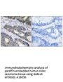 Anti-GLB1L3 Antibody