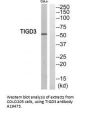 Anti-TIGD3 Antibody