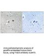 Anti-TIGD3 Antibody