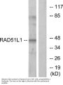 Anti-RAD51L1 RAD51B Antibody