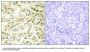 Anti-RAD51L1 RAD51B Antibody