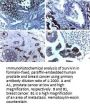Anti-Survivin birc5.1-a Antibody