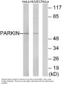 Anti-Parkin PARK2 Antibody