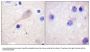 Anti-Parkin PARK2 Antibody
