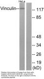 Anti-Vinculin VCL Antibody